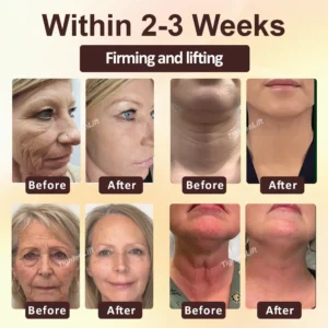 ATTDX® ApisRepair Firming Serum Stick