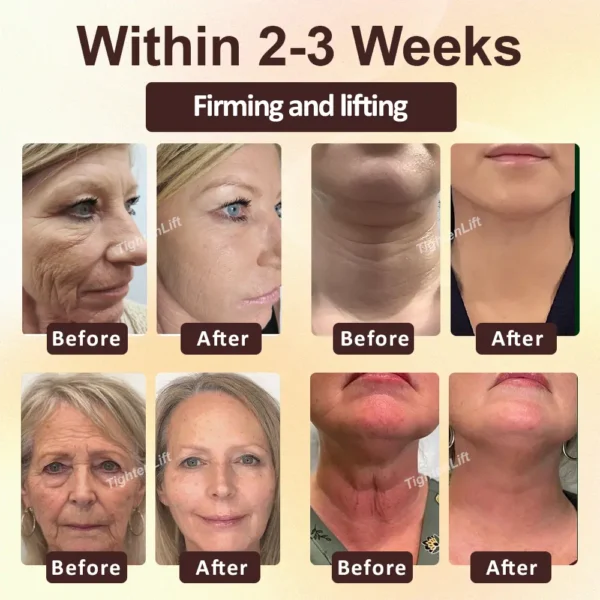 ATTDX® ApisRepair Firming Serum Stick