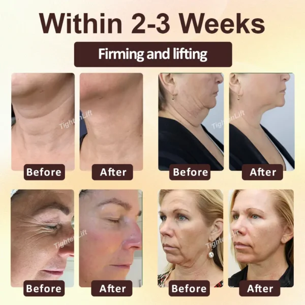 ATTDX® ApisRepair Firming Serum Stick