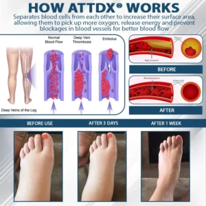 ATTDX® Black Cumin Edema Detox Herbal Cream