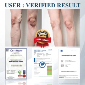 ATTDX® Black Cumin Edema Detox Herbal Cream