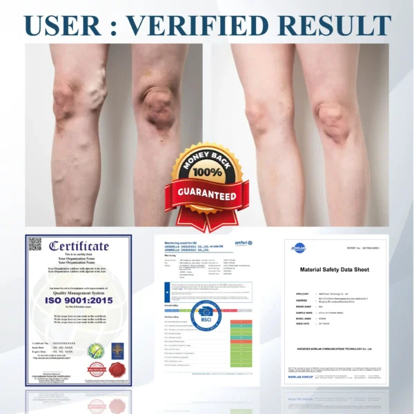 ATTDX® Black Cumin Edema Detox Herbal Cream