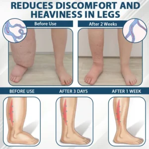 ATTDX® Black Cumin Edema Detox Herbal Cream