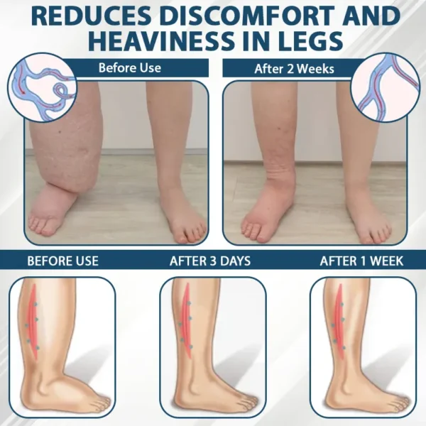 ATTDX® Black Cumin Edema Detox Herbal Cream