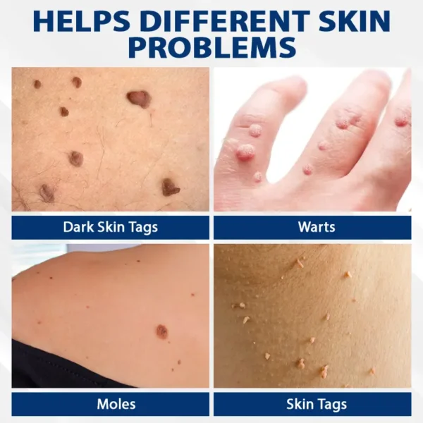 ATTDX® DermaSoft Tag & Mole Clear Gel