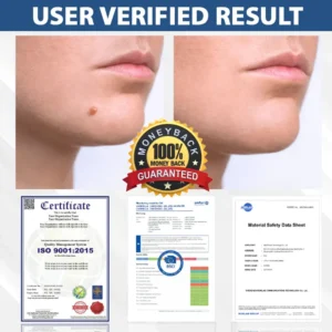 ATTDX® DermaSoft Tag & Mole Clear Gel