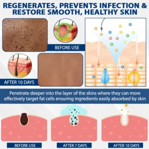ATTDX® DermaSoft Tag & Mole Clear Gel