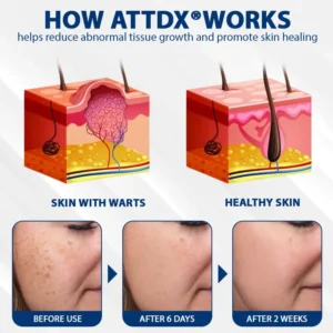 ATTDX® DermaSoft Tag & Mole Clear Gel