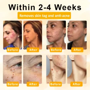 ATTDX® GoldenBee Tag & Blemish Repair Peel Gel Mask