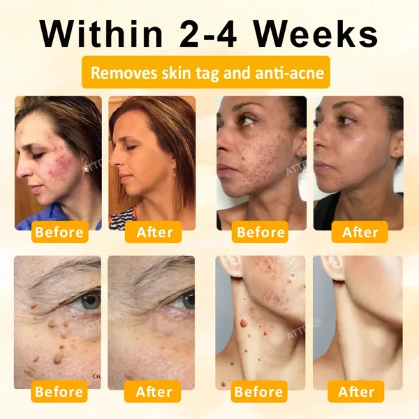 ATTDX® GoldenBee Tag & Blemish Repair Peel Gel Mask