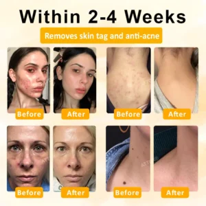 ATTDX® GoldenBee Tag & Blemish Repair Peel Gel Mask