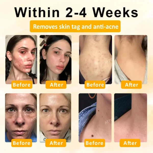 ATTDX® GoldenBee Tag & Blemish Repair Peel Gel Mask