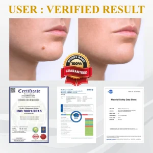 ATTDX® GoldenBee Tag & Blemish Repair Peel Gel Mask