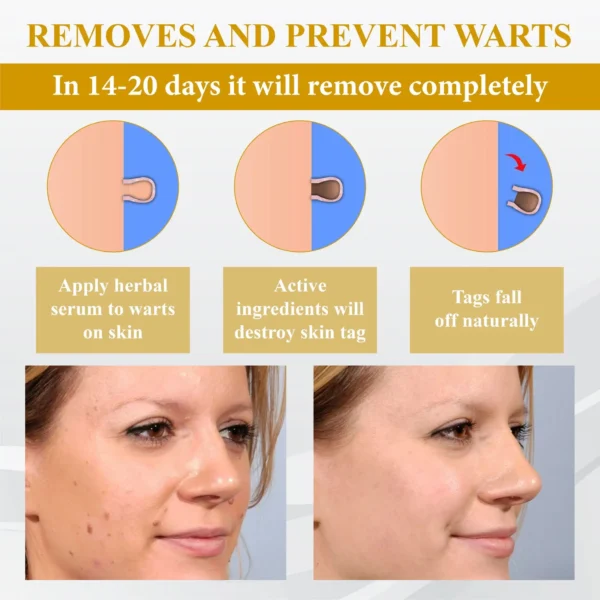 ATTDX® GoldenBee Tag & Blemish Repair Peel Gel Mask