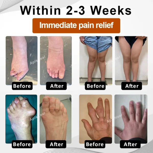 ATTDX® InflameHeal Black Cumin Bone Relief Gel