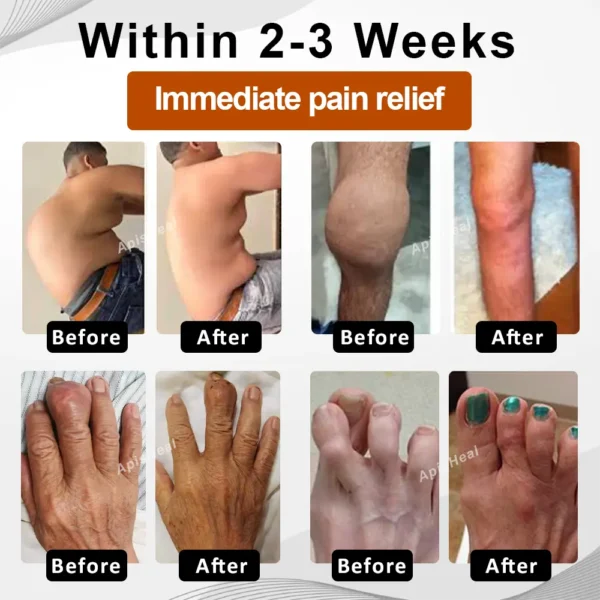 ATTDX® InflameHeal Black Cumin Bone Relief Gel