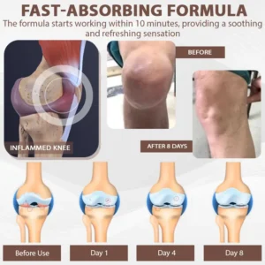 ATTDX® InflameHeal Black Cumin Bone Relief Gel
