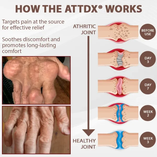 ATTDX® InflameHeal Black Cumin Bone Relief Gel