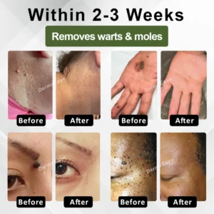 ATTDX® Skin Clear Herbal Jelly Gel