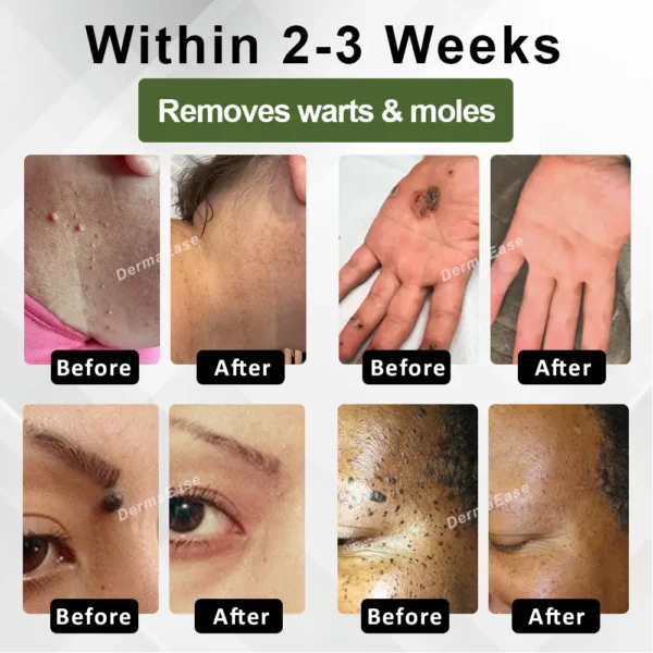 ATTDX® Skin Clear Herbal Jelly Gel