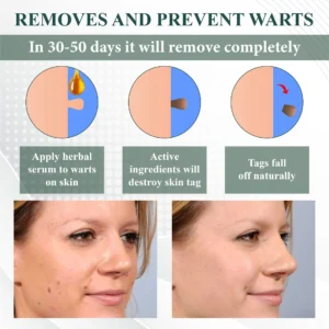 ATTDX® Skin Clear Herbal Jelly Gel