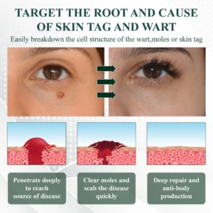 ATTDX® Skin Clear Herbal Jelly Gel