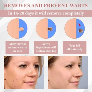 ATTDX® Tag & Blemish Peel-Off Gel Wrapping Mask