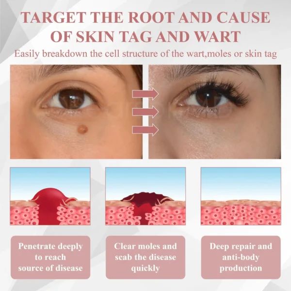 ATTDX® Tag & Blemish Peel-Off Gel Wrapping Mask