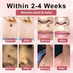ATTDX® Tag & Blemish Peel-Off Gel Wrapping Mask
