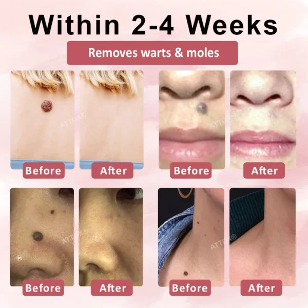 ATTDX® Tag & Blemish Peel-Off Gel Wrapping Mask