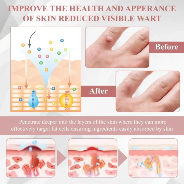 ATTDX® Tag & Blemish Peel-Off Gel Wrapping Mask