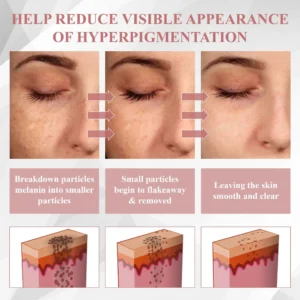 ATTDX® Tag & Blemish Peel-Off Gel Wrapping Mask