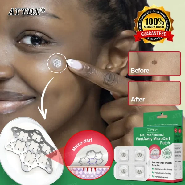 ATTDX® Tea Tree Focused WartAway MicroDart Patch