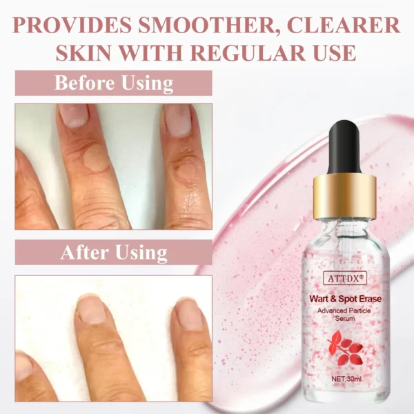 ATTDX® Wart & Spot Erase Advanced Particle Serum