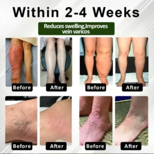 ATTDX® CircuHerb Edema Soothing & Healing Balm