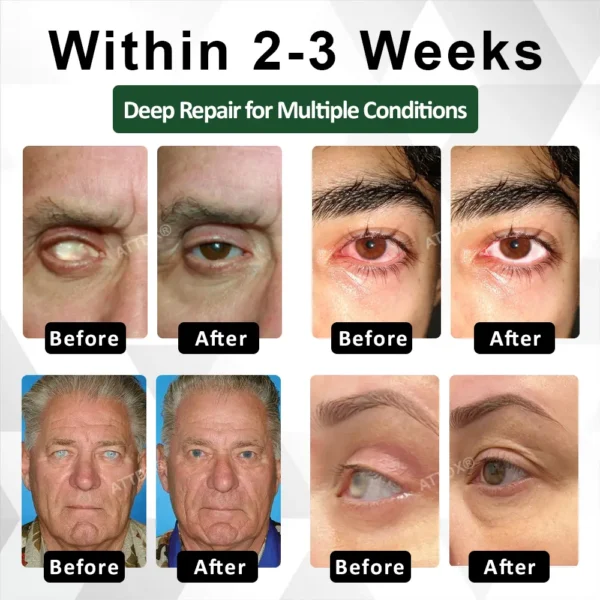 ATTDX® NanoCore Eye Clear Drops Serum