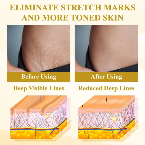 ATTDX® ApisPDRN DermoFirm Lifting Cream
