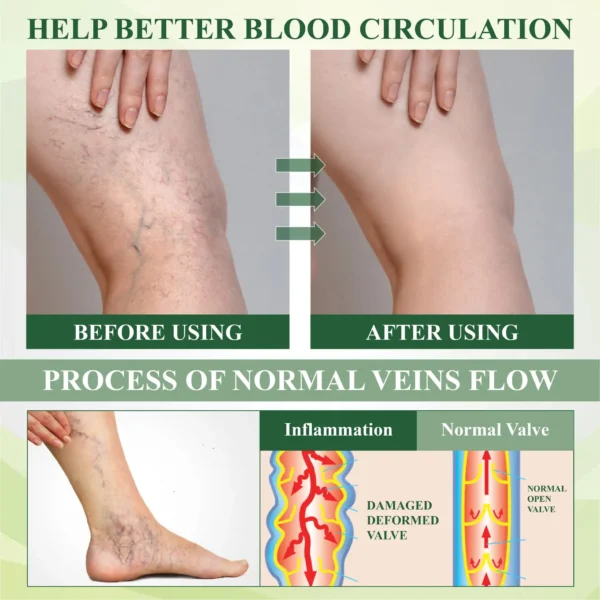 ATTDX® CircuFlex Leg Therapy Edema Spray