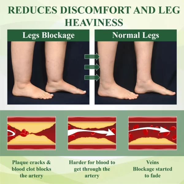ATTDX® CircuFlex Leg Therapy Edema Spray
