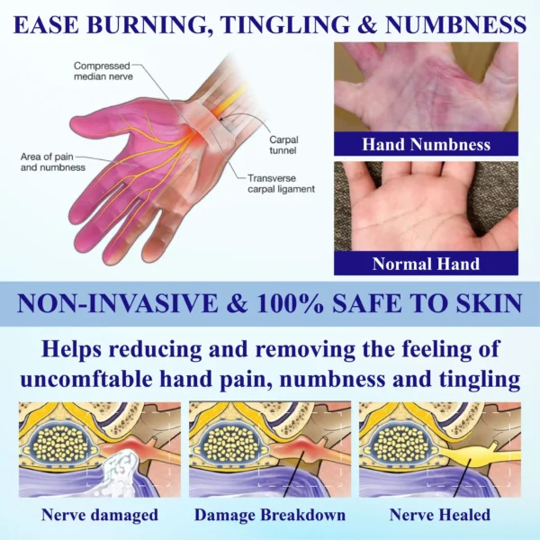 ATTDX® NumbAway CoolEase Neuropathy Spray