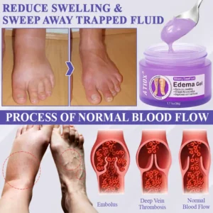 ATTDX® Bilberry EaseFluid Edema Gel