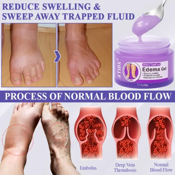 ATTDX® Bilberry EaseFluid Edema Gel