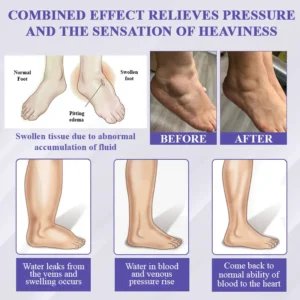 ATTDX® Bilberry EaseFluid Edema Gel