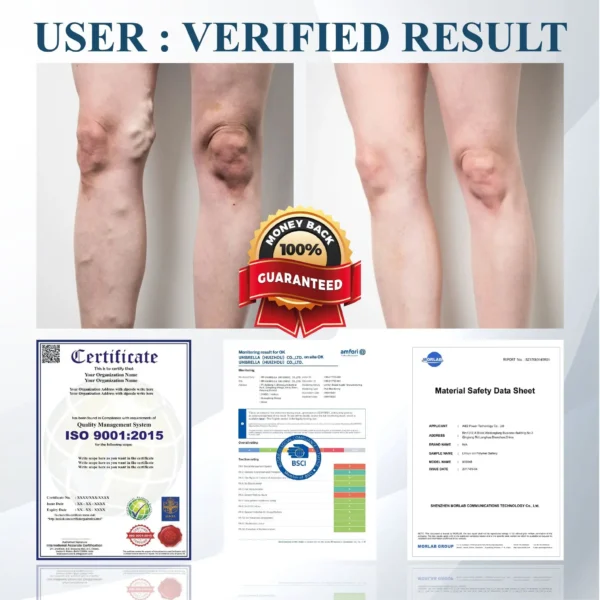ATTDX® Black Cumin Edema Soothing Herbal Cream -👩‍⚕️Doctor-Endorsed Herbal Formula