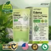 ATTDX® Edema Drain Duo Therapy Roller Cream
