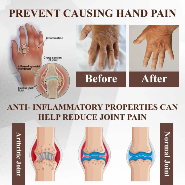 ATTDX® Emu Oil Turmeric UricRelief Therapy Gel