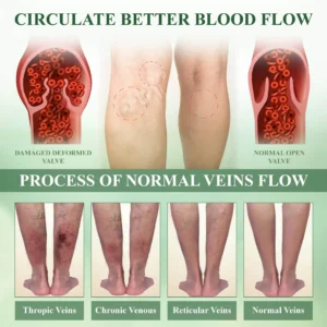 ATTDX® FluidEase Leg Therapy Edema Cream 2