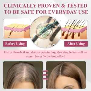 ATTDX® Hair Reawaken PP405 Roll-On Serum for Women 👩