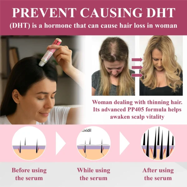 ATTDX® Hair Reawaken PP405 Roll-On Serum for Women 👩