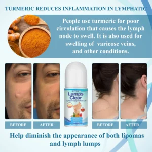 ATTDX™ LumpsClear Lymph Support Roll-On